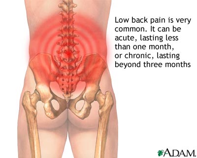 What To Do When Lower Back Pain Strikes?