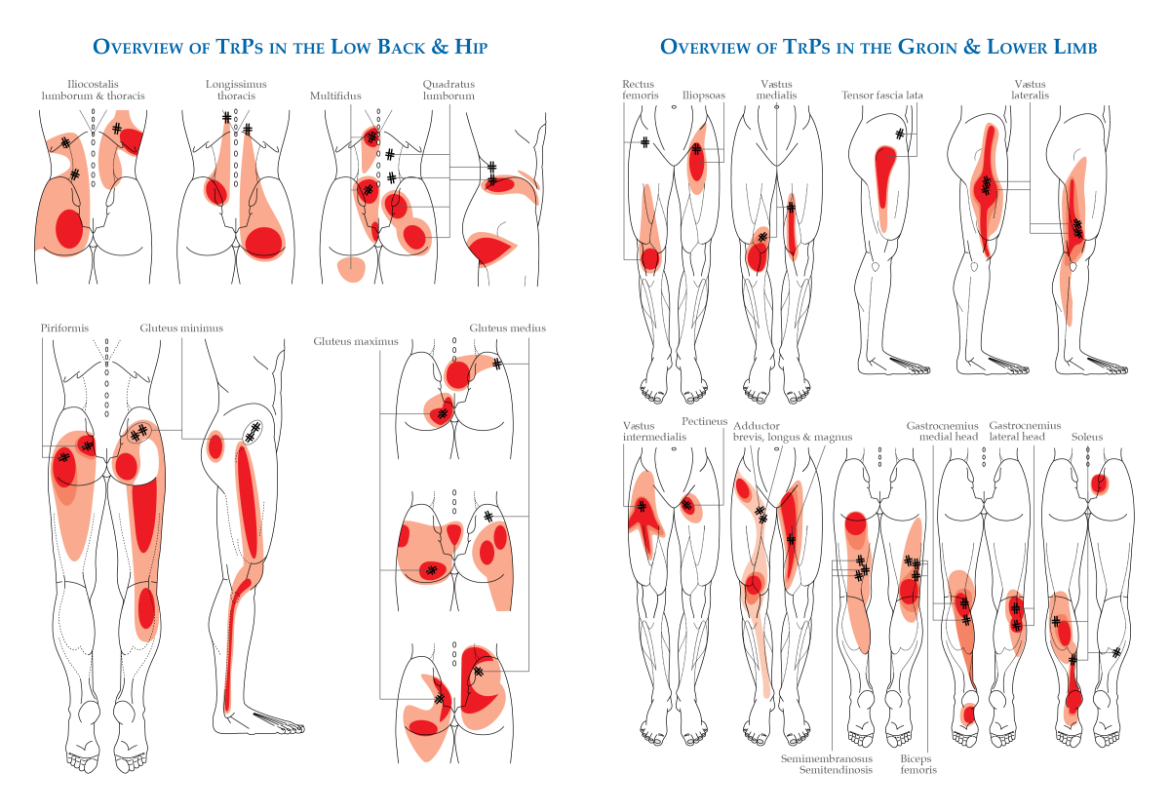 MSK mimics of LS radiculopathy – part 2 – The BMAS Blog