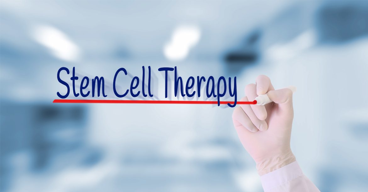 Mesenchymal Stem Cells: What You Should Know